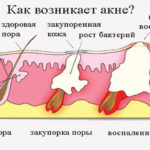 Аналоги «Пантенол» і їх властивості